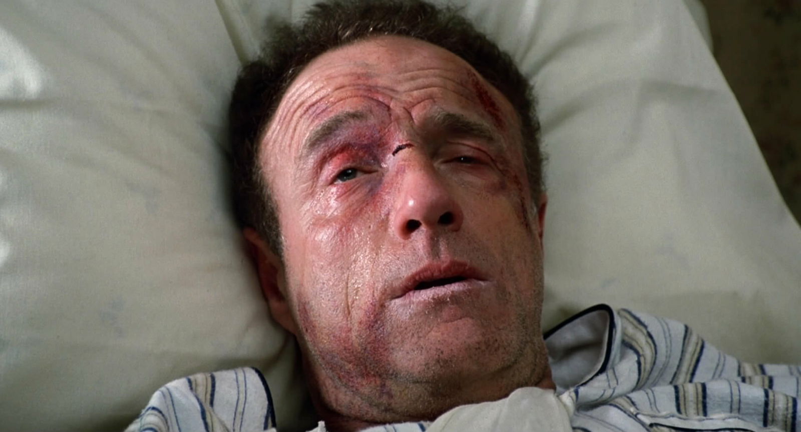 Lo scrittore Paul Sheldon (James Caan) protagonista di Misery non deve morire