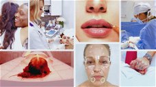 Portada de Skin Decision: Antes y Después, porque la serie de Netflix no es como otros programas sobre medicina estética